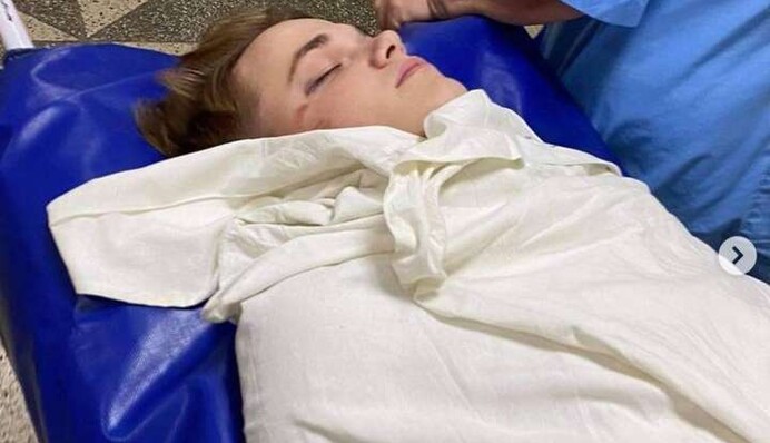 Побиття танцюриста Наді Дорофєєвої: нападник хотів 