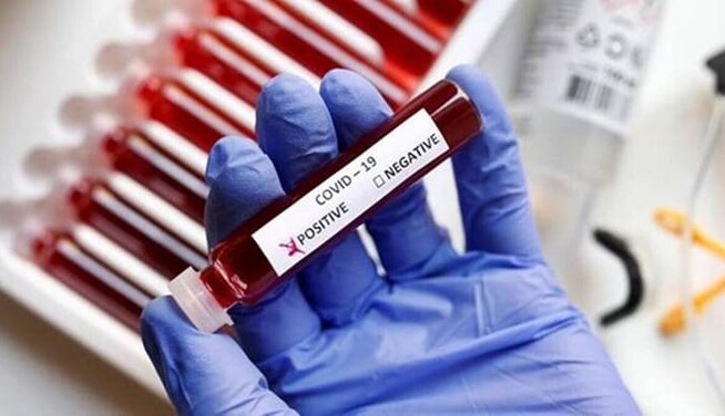 Влада б'є на сполох: українська область в кроці від 