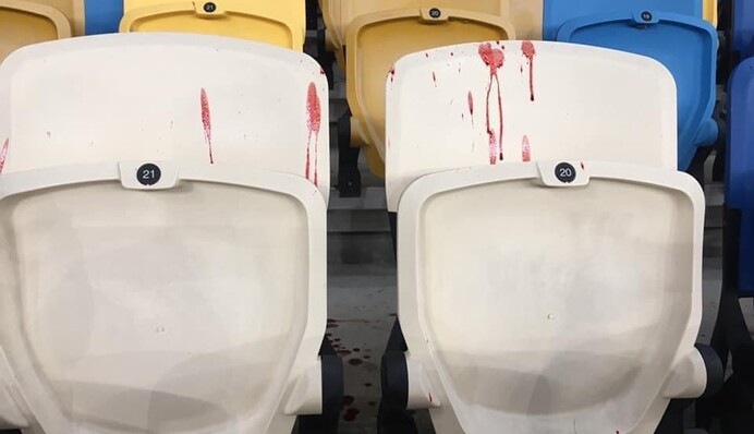 Обіцяють покарати: у Динамо відреагували на напад ультрас на вболівальників