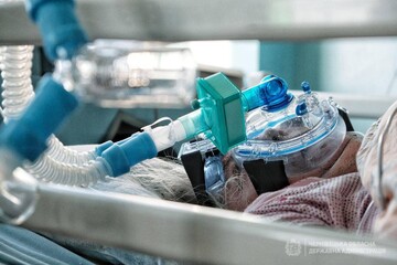Реанімації ковід-лікарень у Чернівцях забиті на 100%: влада звернулася до городян
