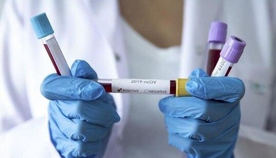 В Україні майже 14 тисяч нових випадків COVID-19 за добу: статистика на 1 листопада