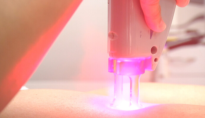 Лікар розповіла, чи безпечна лазерна епіляція для жіночого здоров'я