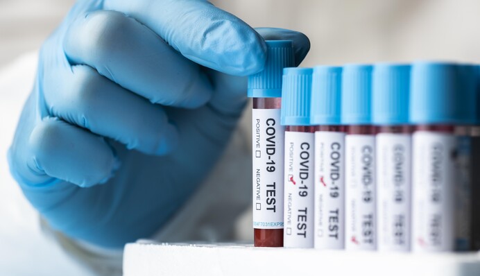 В Україні понад 7 тисяч нових випадків COVID-19 за добу: статистика на 12 січня