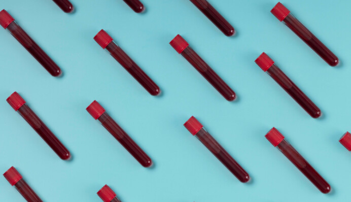 В Україні різко зростає кількість хворих на COVID-19: де ситуація найгірша