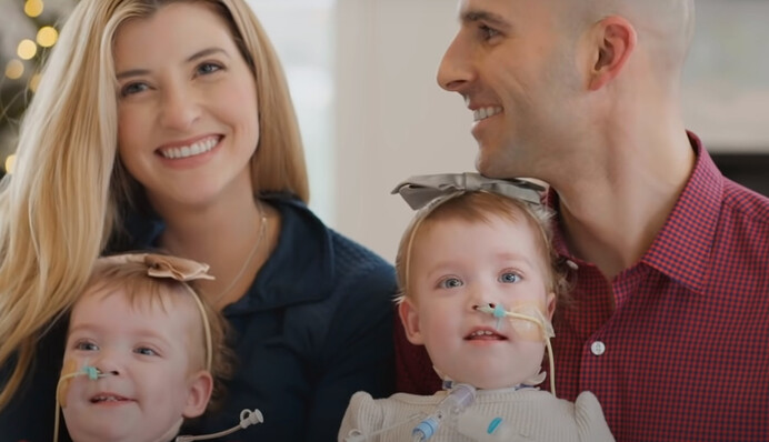 В США успешно разделили сиамских близнецов - у них была общая печень и диафрагма