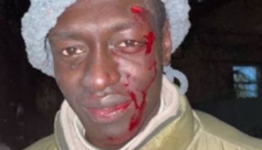 В Киеве таксист избил пассажира, попросившего включить радио: фото