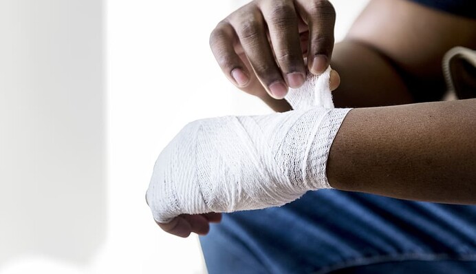 Що робити при опіку та як уникнути помилок у першій допомозі: поради лікарів