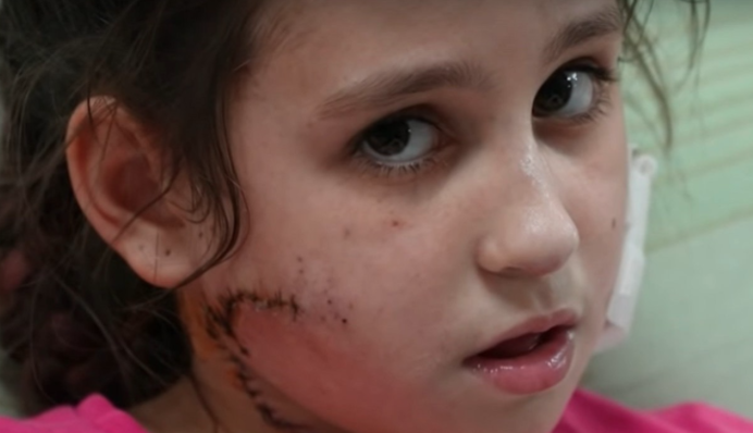 У Маріуполі окупант вистрілив 11-річній дівчинці в обличчя: подробиці та відео