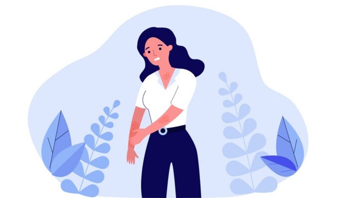 Що робити, якщо на тілі з'явився висип: поради лікаря та помилки самолікування