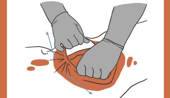 В Украине появилось приложение, которое научит оказывать первую помощь до приезда врачей