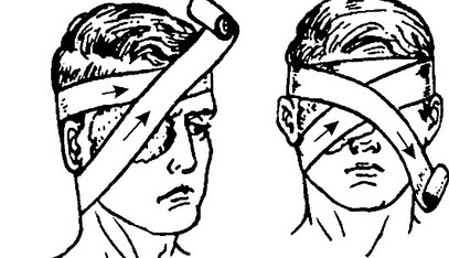 Врач рассказала, как оказать первую помощь при травмах и ожогах глаз