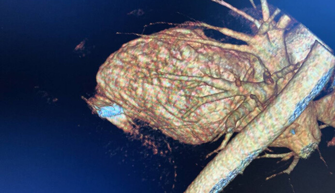 Біг від окупантів із кулею в серці: в Україні дивом врятували життя 20-річному військовому, фото