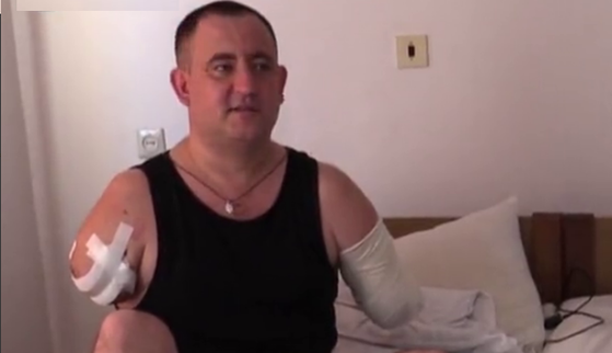 Остался без обеих рук: эвакуированный из 