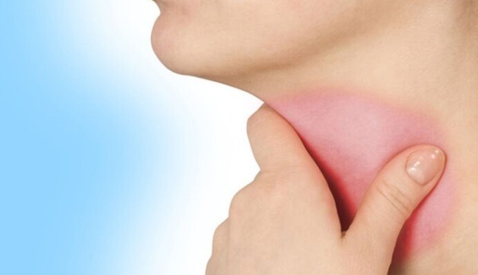 Як надати першу допомогу при набряку Квінке - важкій алергічній реакції