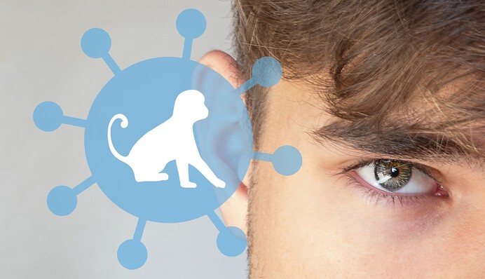 Нужно быть бдительными: врач рассказала, стоит ли ждать оспу обезьян в Украине