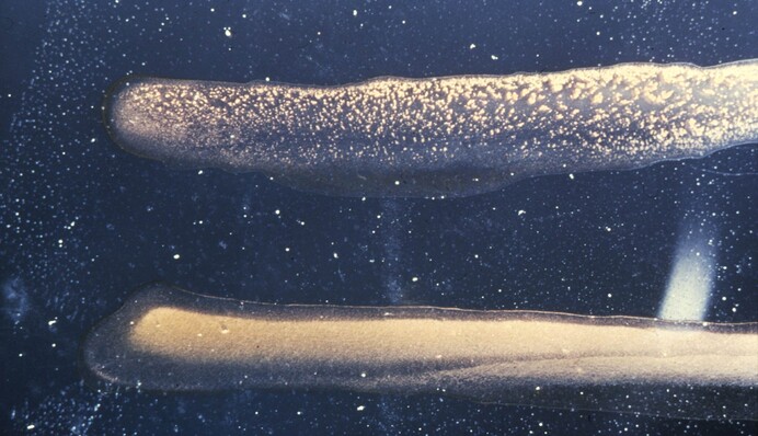 Грозит ли Украине вспышка холеры: Минздрав ответил на слухи из соцсетей