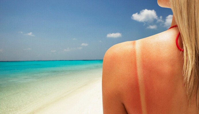 Як проявляється алергія на сонці і чи можна її позбутися