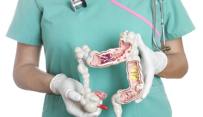 Виразковий коліт: головні симптоми та лікування хвороби