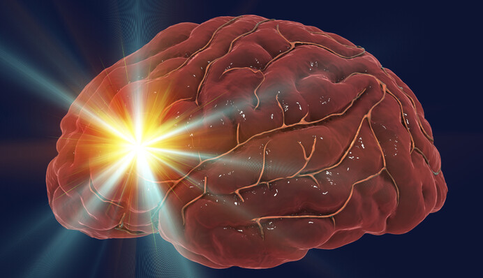 Лікар назвала три періоди в житті жінок, коли ризик інсульту найвищий