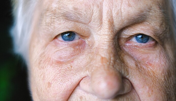 Встановлення групи інвалідності: які зараз критерії та що треба для отримання пенсії