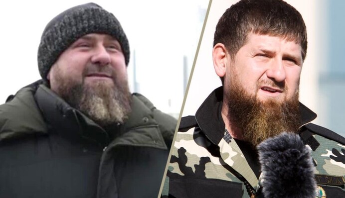 Почему Кадыров выглядит опухшим? На Западе узнали подробности про его болезнь