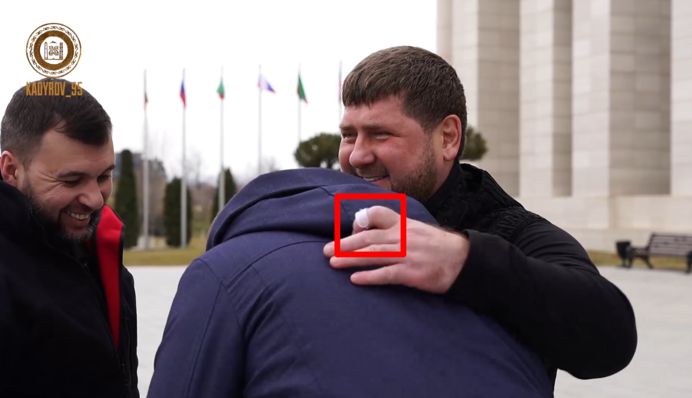 Кадыров болен 