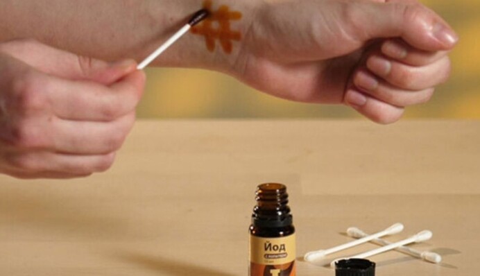 Полезно ли делать йодную сетку: мифы и факты об известном методе