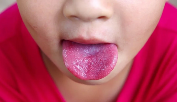 Уже не коронавирус: на Закарпатье среди детей распространяется опасная болезнь