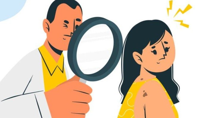 Коли родимка стає небезпечною: 5 ознак, які вимагають звернення до лікаря