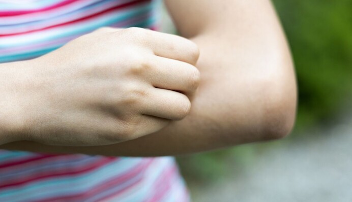 Як проявляється хвороба Лайма після укусу кліща: симптоми, які варто знати