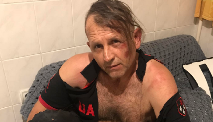 Експолітв'язень Володимир Балух розповів про побиття його поліцією в Києві: фото