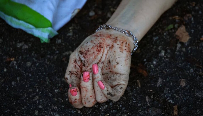 Обломок ракеты ударил в спину: появились подробности о жертве удара РФ в Запорожье, фото