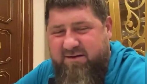 Готовят к новой операции: появились новые данные о состоянии Кадырова