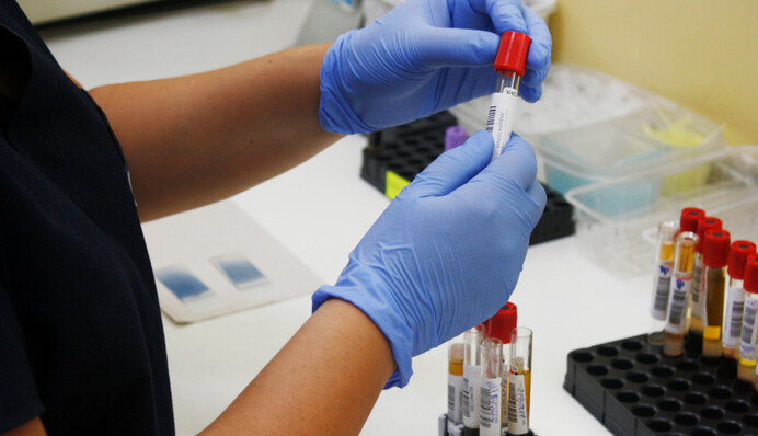 Ще в одній області України зафіксували гепатит А: що відомо