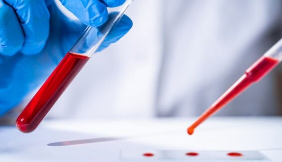 В Україні виявили новий варінт коронавірусу: чим небезпечний 