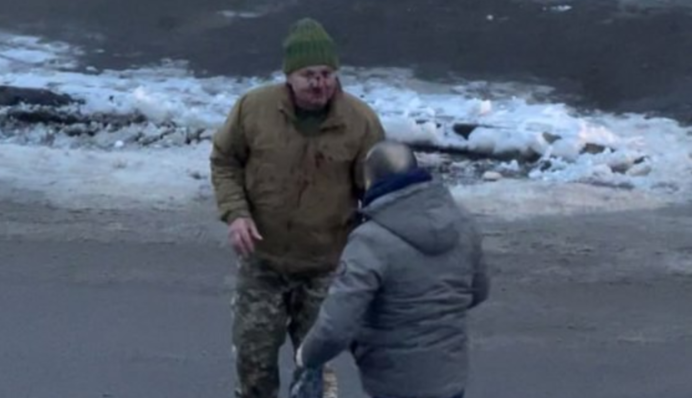 На Прикарпатті п’яний побив військовослужбовця: подробиці інциденту і відео нападу