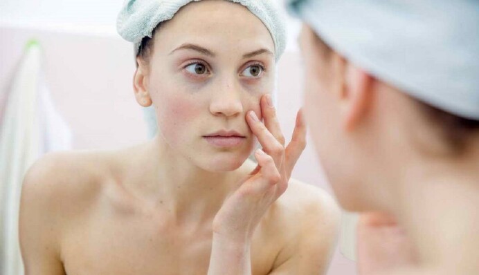 Почему возникают отеки: врач назвала основные причины