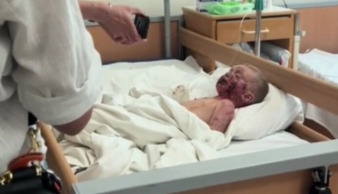 Появилось шокирующее видео с 2-летним ребенком, пережившим обстрел больницы 
