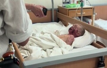 З'явилось шокуюче відео з 2-річною дитиною, яка пережила обстріл лікарні "Охматдит"