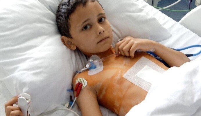 Умер еще один мальчик, лечившийся в "Охматдете" во время удара