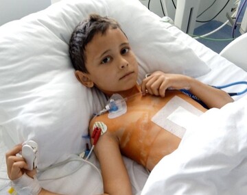 Помер ще один хлопчик, який лікувався у "Охматдиті" під час удару