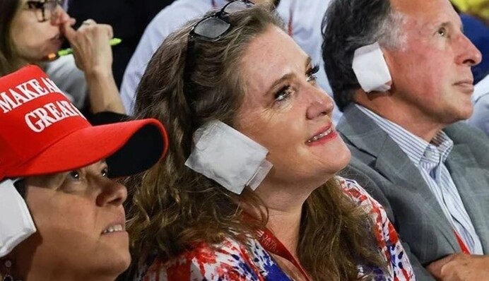Фанатиков Трампа высмеяли за наклейки на ушах
