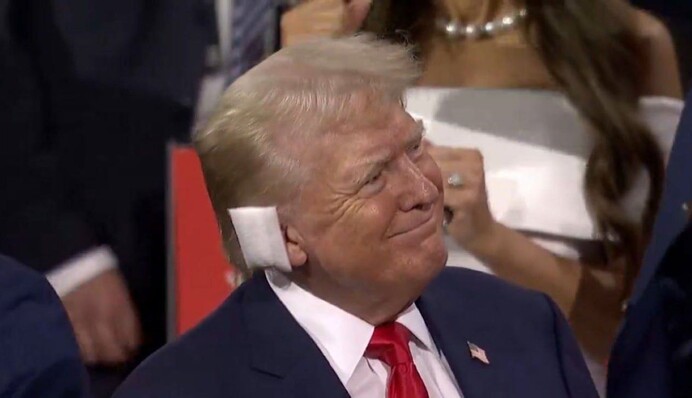 Вухо Трампа роздивились без пов'язки та запідозрили обман