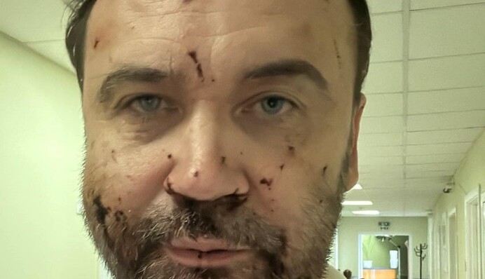 Ілля Пономарьов показав фото своїх поранень та уламків дрону, який ого атакував