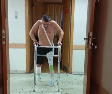 У Росії окупант, який воював в Україні, отримав протези з пляшок