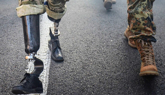 Одну з країн світу вразила українська держпрограма з протезування