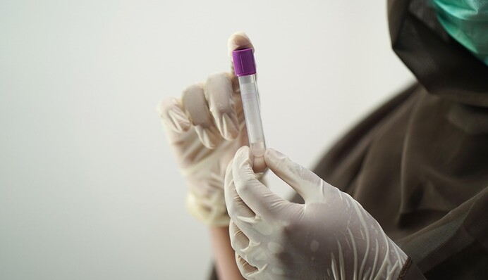 «Нашли чем пугать»: военный посмеялся над новым вирусом, который нашли в Китае