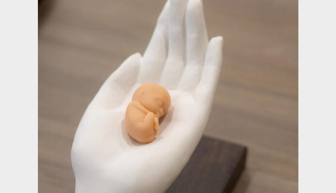 В России придумали, как отговорять женщин от абортов