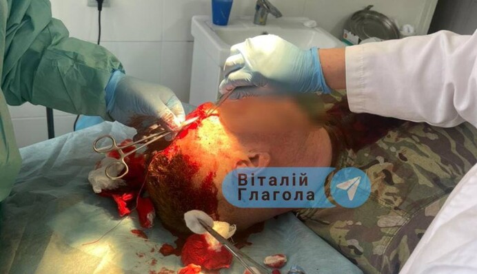 На Закарпатті сталася стрілянина між ромами та прикордонниками