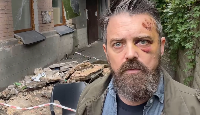 На американського режисера впав балкон у Києві